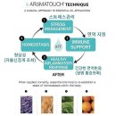지원테크닉