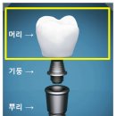 세종치과기공소 이미지