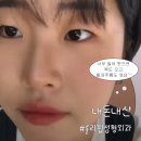 롤리팝성형외과의원 | 웃는것도 내 맘대로 못하는 인생