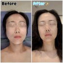 역] 검단피부관리 당하동피부관리 전문 제이에스JS에스테틱 얼굴 스페셜 관리로 붓기 싹 빼고 온 솔직 후기