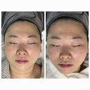 솔마루향기 | 정관피부관리 올가드림뷰티 정관모전점 홍조관리 후기