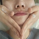 광진 군자로 | 광진구 군자 피부관리 우아에스테틱 여드름관리 상세후기