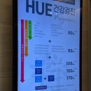 서울휴병원 | 10살 강아지 머리 혹 종괴 종양 제거 수술 후 실밥 푸는 날 비용 (성남 휴동물의료센터)