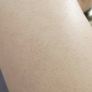 버프짐 | 우레아 70,000ppm 함유! 모공각화증 케어 바디로션 솔직 후기 (익스트림 버프)