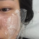 형곡동로3R-7 | 구미 형곡동 메리뷰티 기미 주근깨 제거&amp; 속눈썹펌 내돈내산 후기