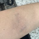 아사비야 | 202512 임신 세번째 기록_