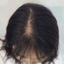헤어달로스