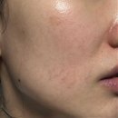 진솔약국 | 리쥬비넥스 크림 내돈내산 사용법 후기