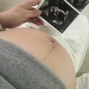 봉봉약국 | 부가부드래곤플라이, 브라운체온계, SK매직정수기, 아카시아봉봉, 설연휴, 에시앙범보의자, 분유쉐이커)