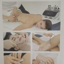 청담세란의원 파셀라 리프팅 후기｜결혼식·상견례 전 얼굴관리 추천