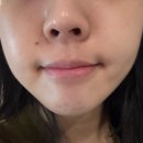 노원역피부관리, 수분 가득한 피부 만들어주는 얼짱몸짱노원점