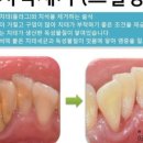 e그린치과의원 네이버블로그