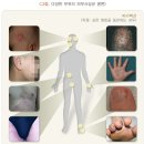 백선세탁 이미지