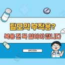 큰사람들 | 탈모약 부작용 7가지 - 복용 전 꼭 알아야 할 효과와 후기