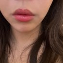 하이엔드 멍 | 입술필러 하이엔드 솔직 후기 내돈내산 7일차 양재역 도곡동 피부과