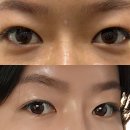 레알성형외과의원 | 울쎄라리프팅, 스킨부스터 리쥬란, 에이비주사, 윤곽주사 효과/통증/비용 리얼후기 (feat.대박 추천)