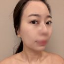 머바르니스파&에스테틱 | 보정동피부관리 머바르니스파&에스테틱 결혼 일주일전 웨딩윤곽관리 후기