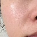 막지 | 포텐자 모공 흉터 후기 모공 막지 않는 논코메도제닉 크림 [샤블 디플러스] 내돈내산 후기