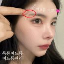 대박 | 목동여드름 여드름관리 대박 후기 꾸준한치료 추천