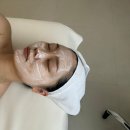 서면윤곽관리 신부관리 코아페이즈 리프팅 후기