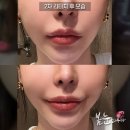 봄눈피우다의원 이미지
