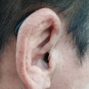 독일렉스톤보청기 의정부점 이미지