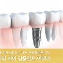 효자효치과 네이버블로그