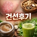 계양 | 서구건선 후기 / 계양구건선 후기 (무료샘플)