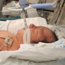 동탄우리약국 | 동탄제일병원 제왕절개, 신생아 선천 폐렴, 기도삽관, NICU 니큐 입원 후기