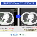 티시바이오 이미지