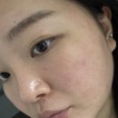 속당김 건성피부 인생템 찾았다, 비누원 엔젤수분크림(건성용) 솔직후기