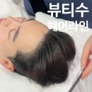 M자 라인 고민? 자연스러운 헤어라인 디자인 후기