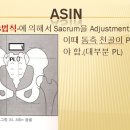 총체적 천골교정 PR(PL)이란? Sacrum PR(L), PIR(L), Listing Adjustment/Thrust/Manipulation 이미지