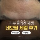 네오필 | 피부 콜라겐 재생 / 니오라 네오필 세럼 후기