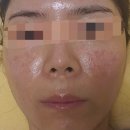 제일건강한약국 | 접촉성 피부염 약국 연고와 같이쓴 크림(+후기있음)