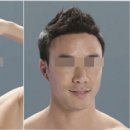 이지헤어라인 이미지