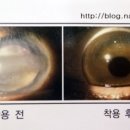 홍채안경원 이미지