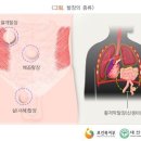 소아탈장 분류표【별표89】 이미지