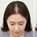 헤어랑두피랑