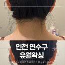 제기46 | [인천/연수구 왁싱] 난생처음 왁싱샵 목도 길어보이고 깔끔해진 뒷목 왁싱 후기 ‘유월왁싱’