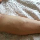 사라메디칼 이미지