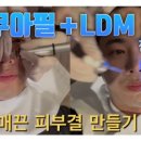 필밸런스의원 | 아쿠아필 LDM 피부결 완성 후기