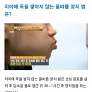 커피, 탄산음료 마신 후 바로 양치질하면 안 되요. 이미지