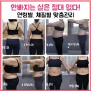 호이플랜
