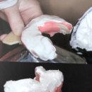 엘치과기공소 이미지