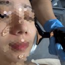 샤이니에스테틱 | 프라이빗해서 좋은 역북피부관리 나투어 에스테틱 솔직후기(샤이니 펌킨필)