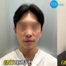 강남더의원 네이버블로그