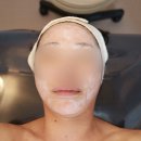 셀바디 | 전주서신동피부관리 나이스바디&amp;스킨 써마트릭스 휴템셀 리프팅 후기