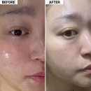 [수원 영통 바디관리] 푸석푸석 건조한 피부, 포이에마피부샵에서 스티키마사지 받고 온 후기🍎