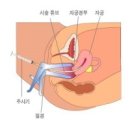 대동시장 김무원내과앞 | 나도 하고야 말았다,나팔관 조영술,서주내과